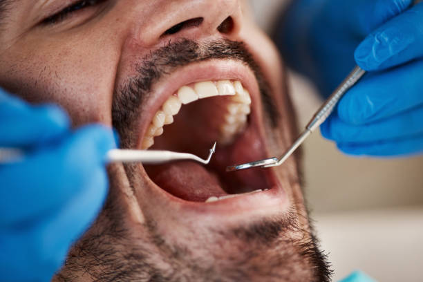 Best Root Canal Treatment  in Granville South, OH